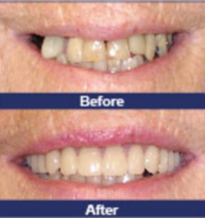 CALEDONIA DENTURE CLINIC Updated August 2024 35 Caithness Street E