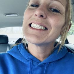 Lighthouse Dental - Teeth whitening treatment. After.