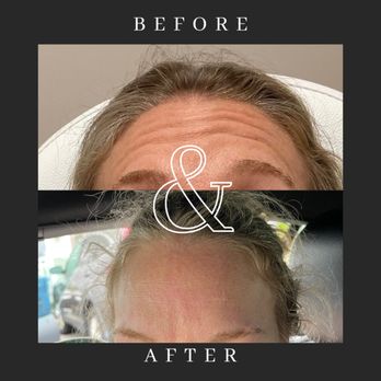 Bella Viso Aesthetics - Medical Spas Near Me - Haverhill, Massachusetts Bella Viso Aesthetics - Medical Spas Near Me - Haverhill, Massachusetts