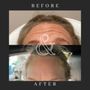 Photo of Bella Viso Aesthetics