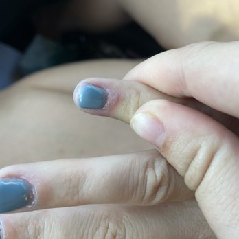Nails Plus - Photos don't do the damage justice, but this is one of three that bled and required cleaning. - Nail Salons Near Me - Virginia Beach, Virginia