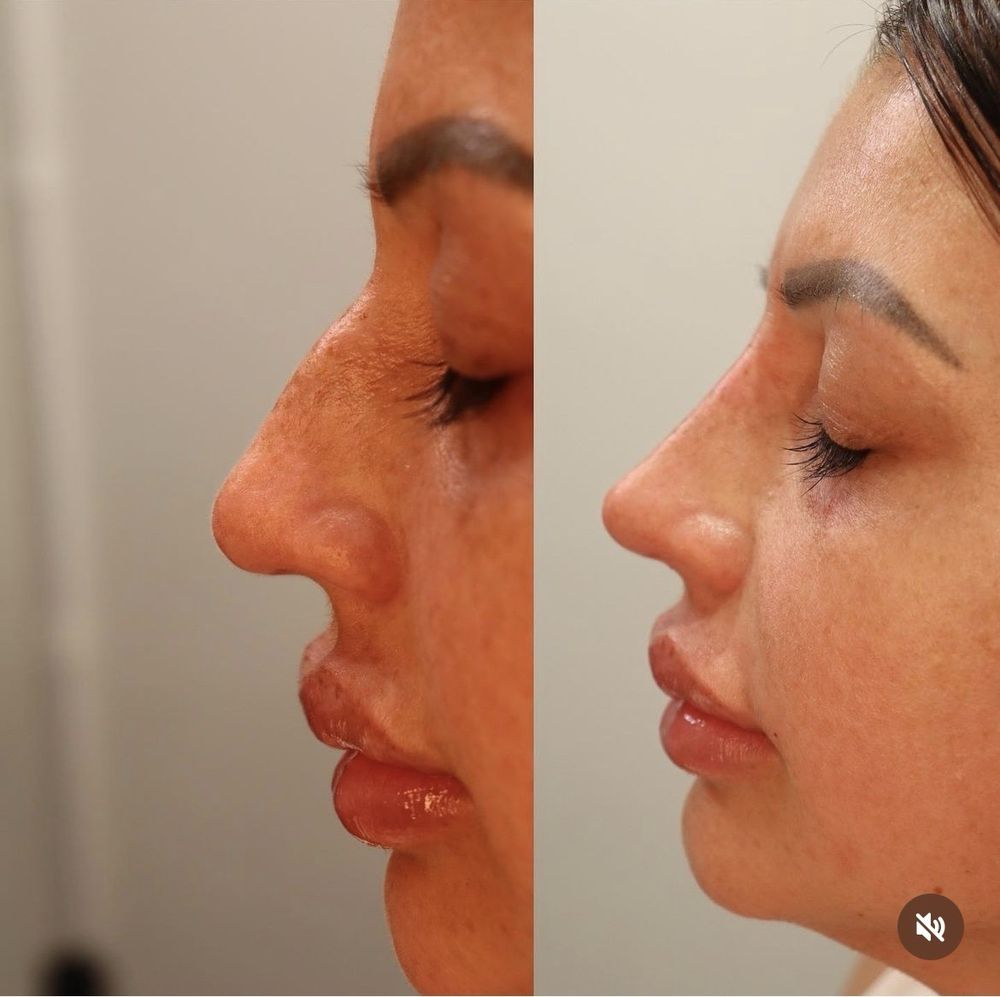 ADD BEAUTY MED SPA Updated October 2024 13 Reviews 11553 Foothill