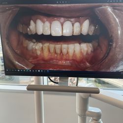 Cosmetic Dentists of Houston - Before treatment