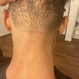 Barber Gashed my neck Barber Gashed my neck