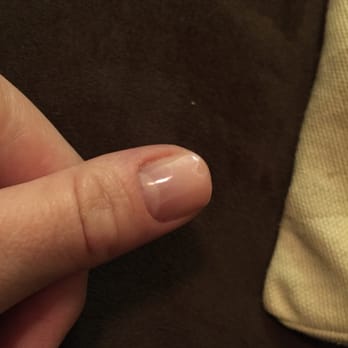 Angel's Nail - CND shellac that I noticed had peeled off when I looked down only 3 hours after getting them done. - Nail Salons Near Me - New York, New York