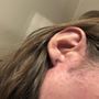 Photo of Mouse and Needle Piercing