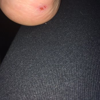 Blush Nail Spa - Cut ankle from pumice tool. - Nail Salons Near Me - Madison, Wisconsin