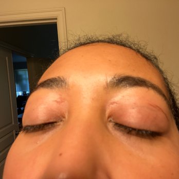 Crystal Nails & Spa - Wounds on upper eyelids after eyebrow wax - Nail Salons Near Me - Everett, Washington Crystal Nails & Spa - Wounds on upper eyelids after eyebrow wax - Nail Salons Near Me - Everett, Washington