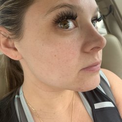 My Skin By Michelle - 13 days AFTER facial and using the products I bought. Already such a difference!!