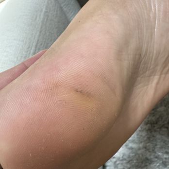 D’Luxe Nail Spa - Checked feet at home... - Nail Salons Near Me - Livermore, California D’Luxe Nail Spa - Checked feet at home... - Nail Salons Near Me - Livermore, California