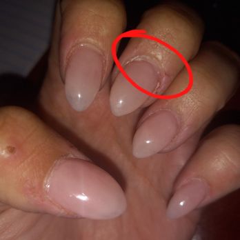 Q-NAILS - Look at the space between the cuticle and the acrylic. This was taken right after I got out of the salon - Nail Salons Near Me - El Centro, California