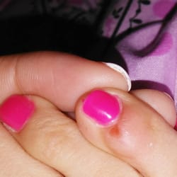 Got while getting a previous gel filed down