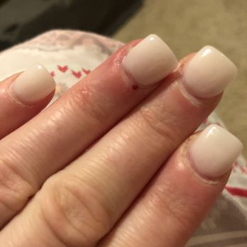 ProTop Nails - My cut that Lisa put glue on. And you can see the gap before the powder starts which makes my nails look like they were done a week ago - Nail Salons Near Me - Roseville, California