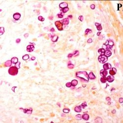 Finan Templeton Dermatopathology Associates