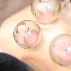 LES Acupuncture & Bodywork - Cupping