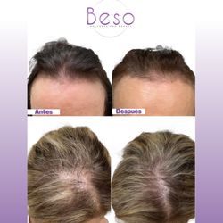 Beso Wellness and Beauty