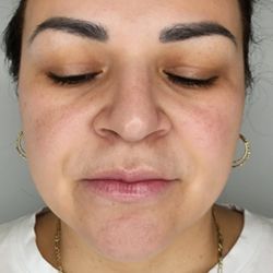 Obtain Confidence | Med Spa