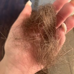 Hair falling out in 1 days worth. Coming out from back of head