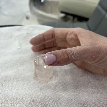 Greenfield Nails and Spa - Chandler - How the original tech "fixed" the nail, plus the bleeding raw area because she filed so deep into my skin - Nail Salons Near Me - Chandler, Arizona