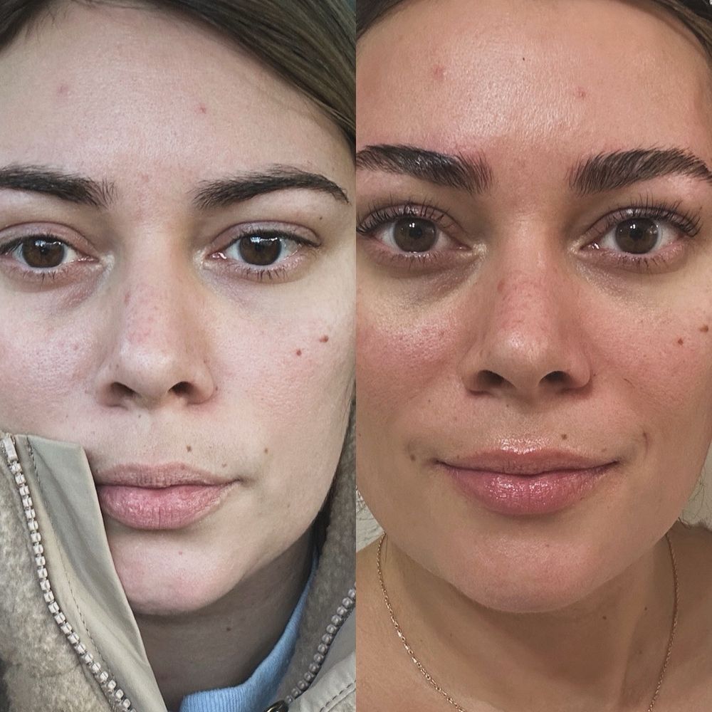 Pretty Brows N Skin - Threading Services Near Me - Colleyville, Texas Pretty Brows N Skin - Threading Services Near Me - Colleyville, Texas