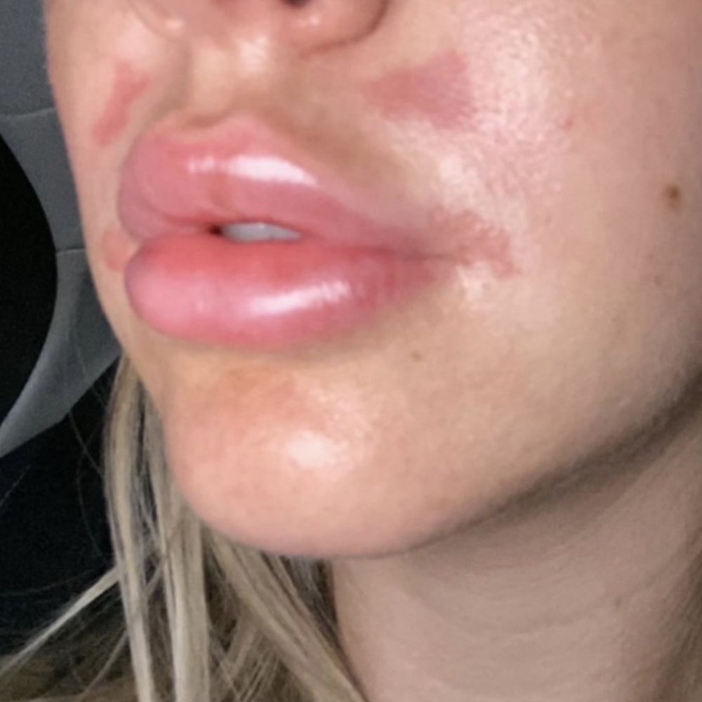 Radiant Waxing - Alon - Lip - Waxing Near Me - San Antonio, Texas Radiant Waxing - Alon - Lip - Waxing Near Me - San Antonio, Texas