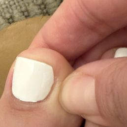 My ruined nail My ruined nail