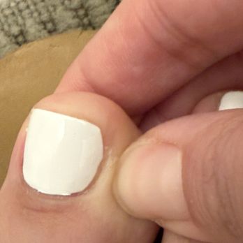 Luna Nails & Spa - My ruined nail - Nail Salons Near Me - Upland, California Luna Nails & Spa - My ruined nail - Nail Salons Near Me - Upland, California