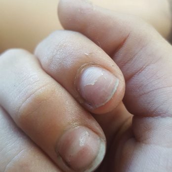 Jolie Nails - After they "removed " my acrylic nail. Half of it is still on there? - Nail Salons Near Me - Antelope, California Jolie Nails - After they "removed " my acrylic nail. Half of it is still on there? - Nail Salons Near Me - Antelope, California
