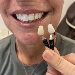 Teeth whitening