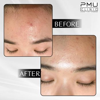 PMU Clinic - Permanent Makeup Near Me - Gilroy, California