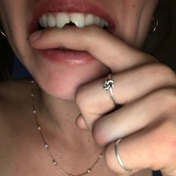 Timothy P Mathis, DDS - the damage!! - Cosmetic Dentists Near Me - Santa Barbara, California