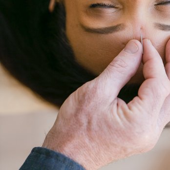 Hidden Rhythm Acupuncture - Acupuncture to Lower Stress - Acupuncture Near Me - Tempe, Arizona Hidden Rhythm Acupuncture - Acupuncture to Lower Stress - Acupuncture Near Me - Tempe, Arizona
