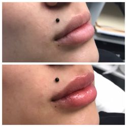 StellarGlo Aesthetics - The best!
