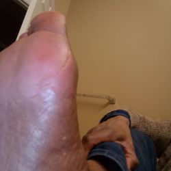 Nail Infinity - I had to seek medical attention days later due to the ache in my instep. The woman twisted her knuckles into my instep.