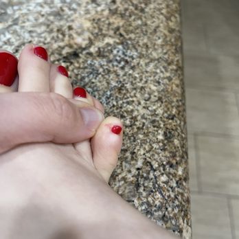 Pure Nails Spa - Cut #2 on my toe from the pedicure - Nail Salons Near Me - Pasadena, California Pure Nails Spa - Cut #2 on my toe from the pedicure - Nail Salons Near Me - Pasadena, California