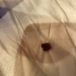 Bone fragment in the "pulled pork", which is not supposed to have bones in it. According to the restaurant this is perfectly acceptable. Bone fragment in the "pulled pork", which is not supposed to have bones in it. According to the restaurant this is perfectly acceptable.