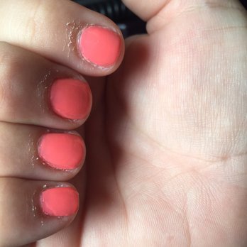 Nails, Spa & More - Look at the skin below the bottom of my nails. What the heck did she do??? - Hair Removal Near Me - Martinez, California Nails, Spa & More - Look at the skin below the bottom of my nails. What the heck did she do??? - Hair Removal Near Me - Martinez, California