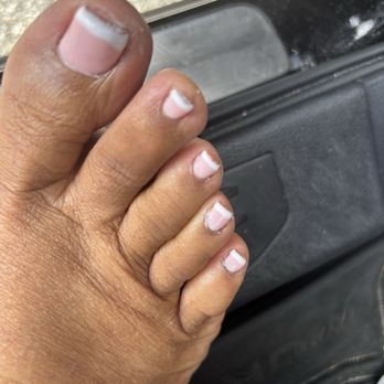 Balanced Soul Wellness - Bad pedicure, lumpy polish and dry skin. - IV Hydration Near Me - Jacksonville, Florida Balanced Soul Wellness - Bad pedicure, lumpy polish and dry skin. - IV Hydration Near Me - Jacksonville, Florida