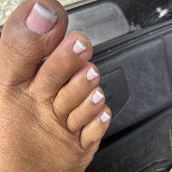 Balanced Soul Wellness - Bad pedicure, lumpy polish and dry skin.