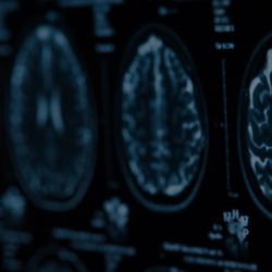 Neurology & Neuropathic Pain Management