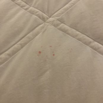 Sheraton Chapel Hill Hotel - The sheets were stained. - Hotels Near Me - Chapel Hill, North Carolina Sheraton Chapel Hill Hotel - The sheets were stained. - Hotels Near Me - Chapel Hill, North Carolina