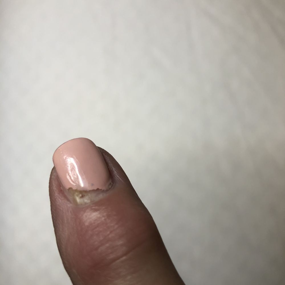 Happy Nails - 2nd time in urgent care - Nail Salons Near Me - Lacey, Washington Happy Nails - 2nd time in urgent care - Nail Salons Near Me - Lacey, Washington