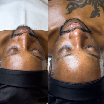 KickAsh Studio - Custom Facial For Oily Skin - Eyelash Service Near Me - New London, Connecticut KickAsh Studio - Custom Facial For Oily Skin - Eyelash Service Near Me - New London, Connecticut