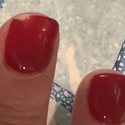 Chipped nail