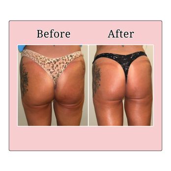 Immortal Skin Wellness - Skin Care Near Me - Wayne, New Jersey