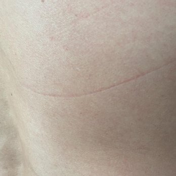 Super Spa - This one was painful after putting some ointment on it to keep the sensation down - Massage Near Me - Hesperia, California