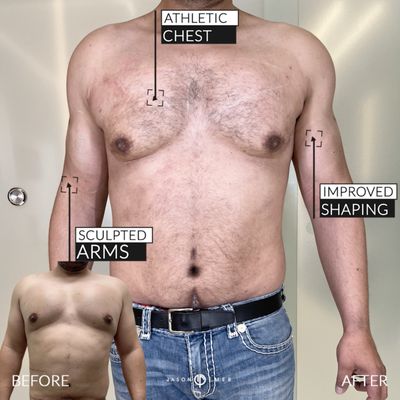 JASON EMER, MD - Updated January 2026 - 1166 Photos & 528 Real Reviews