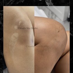 Elevate You Studio - Scar Camouflage Burn Scar
