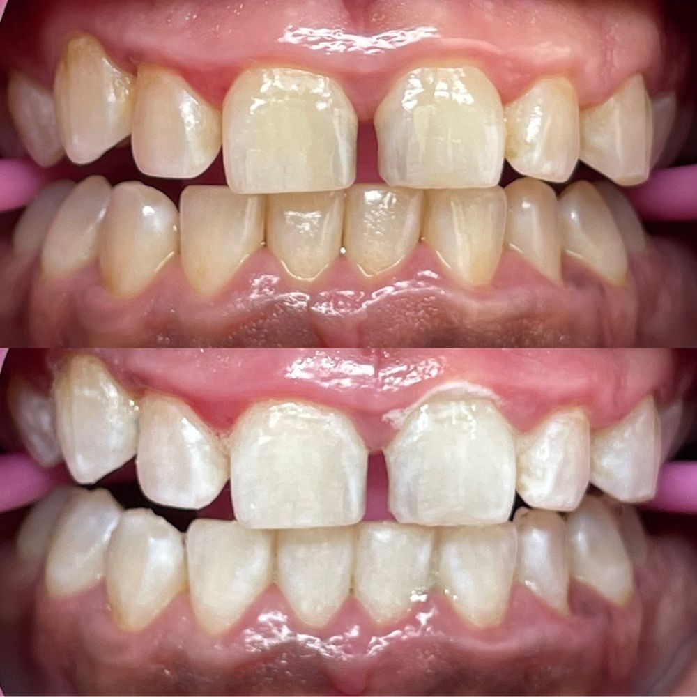 GRILLS Updated August 2024 Request an Appointment 17