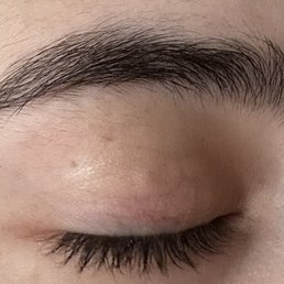 Before